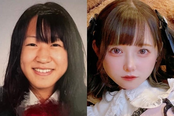 Phẫu thuật thẩm mỹ để có gương mặt như trước khi dao kéo 32 lần-3