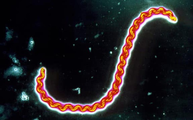 Ghi nhận 2 trường hợp nhiễm xoắn khuẩn vàng da tại Bà Rịa - Vũng Tàu-1