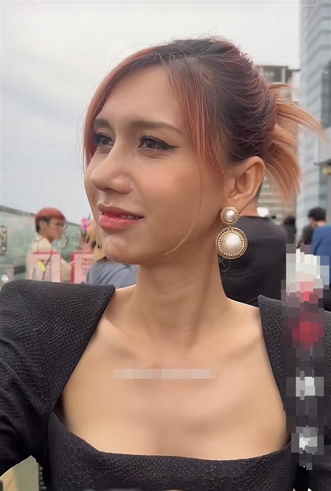 Nhan sắc Lynk Lee hậu sửa mũi gây tiếc nuối-4