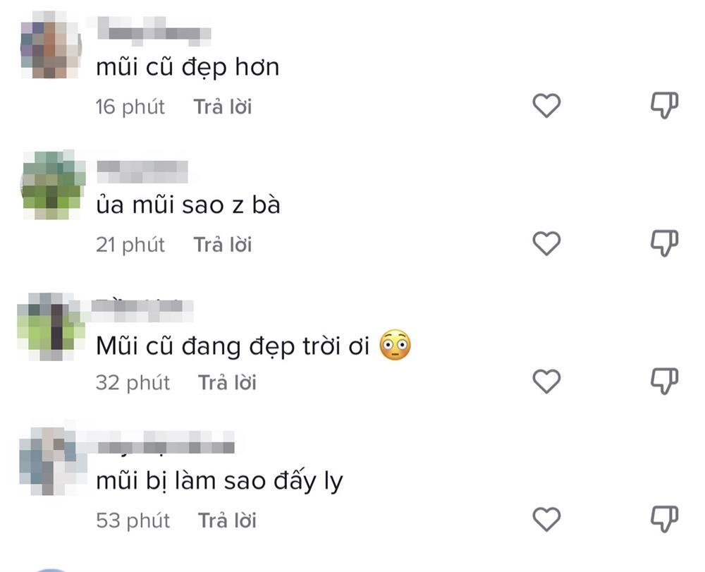 Nhan sắc Lynk Lee hậu sửa mũi gây tiếc nuối-8