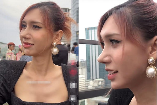 Lynk Lee lần đầu công khai bạn trai sau khi chuyển giới-3