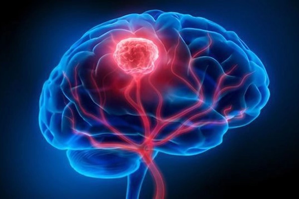 Người phụ nữ 34 tuổi bị nhuyễn xương do thiếu vitamin D: Dấu hiệu cảnh báo dễ nhận ra-4