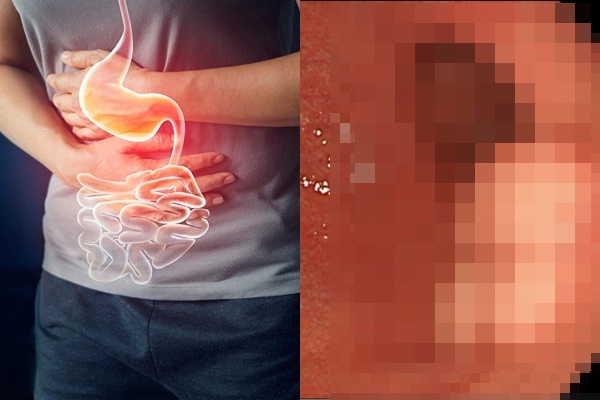 Một kiểu uống nước đã bị WHO cảnh báo rằng có khả năng gây ung thư-5