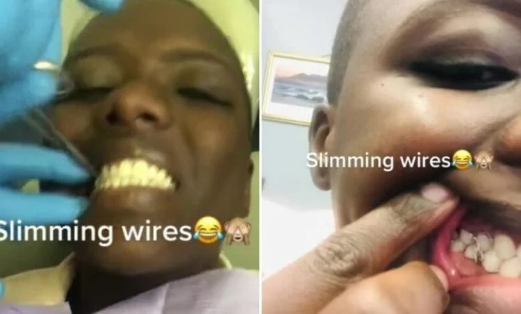 Cô gái bị ném đá khi chia sẻ cách khóa mồm để giảm 12kg-1