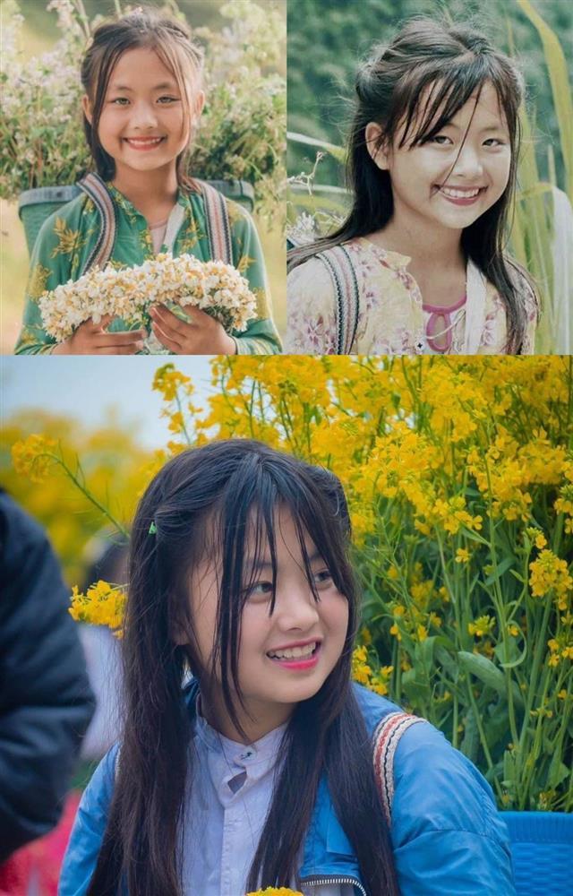 Cô dâu Cao Bằng mí sụp, miệng méo sau 3 năm thẩm mỹ-1