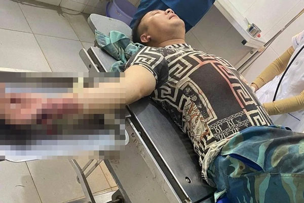 Gã đàn ông bắt sâu trên ngực vợ hàng xóm, chém chồng trọng thương-1