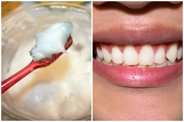 Tầm quan trọng của vệ sinh lưỡi và cách vệ sinh lưỡi đơn giản, đúng cách-1