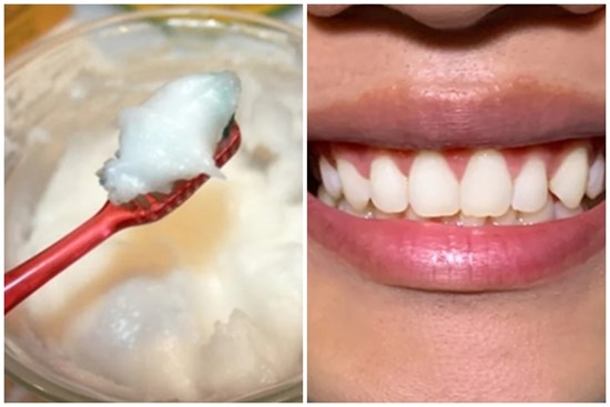 Dùng thứ này để đánh răng: Cao răng bong sạch, hôi miệng kinh niên cũng đỡ hẳn