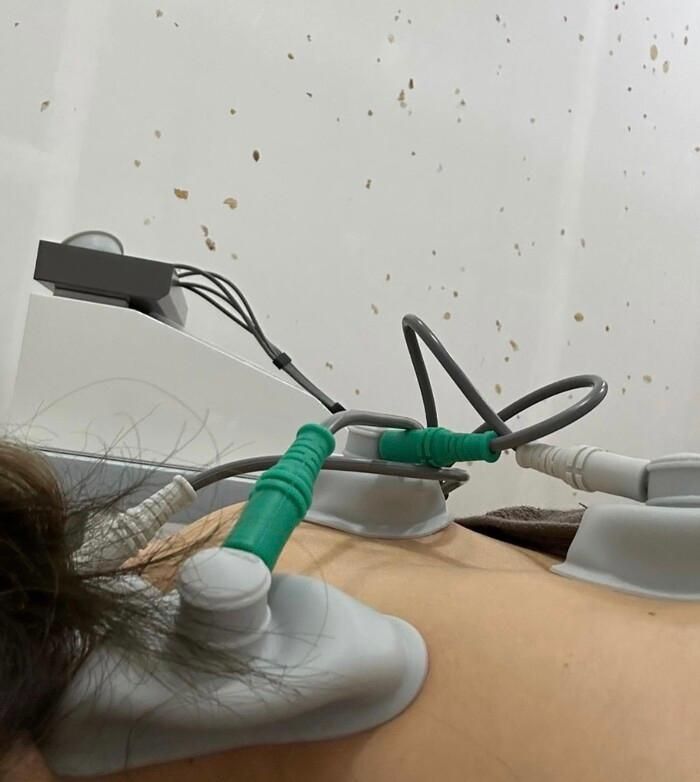 Hari Won tiết lộ tình trạng sức khỏe hiện tại, phải đi châm cứu mỗi ngày-1