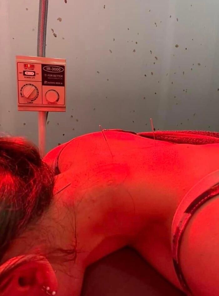 Hari Won tiết lộ tình trạng sức khỏe hiện tại, phải đi châm cứu mỗi ngày-2