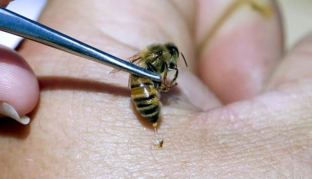 Thực hư thông tin nọc ong chữa ung thư-1