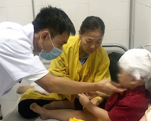 Bé 3 tuổi bị chó hàng xóm cắn trọng thương vùng đầu, mặt-2