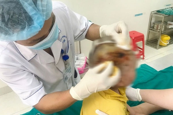 Sụt cân quá nhanh, cô gái qua đời sau 1 năm phát hiện ung thư hạch-2