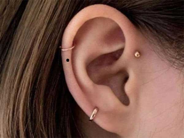 Có nốt ruồi ở những vị trí này ắt là người thông minh, tài trí, tiền đồ rộng mở: May mắn sở hữu một thôi-3