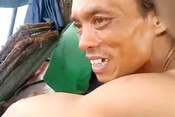 Thiếu tá CSGT bị người vi phạm tông chấn thương sọ não, gãy xương hàm-2