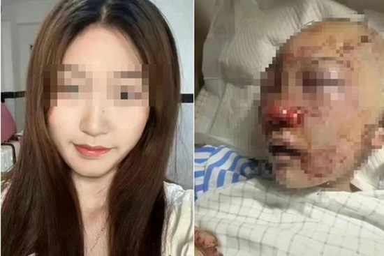 Đi vệ sinh nơi công cộng, cô gái gặp họa kinh hoàng