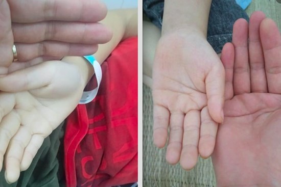 Bé trai Hà Nội da xanh, chóng mặt kéo dài, cha mẹ bất ngờ khi biết nguyên nhân