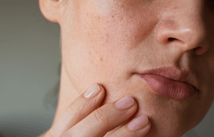 Mẹo giúp da đẹp miễn chê cả mùa Đông mà chẳng tốn tiền đi spa chăm sóc-2