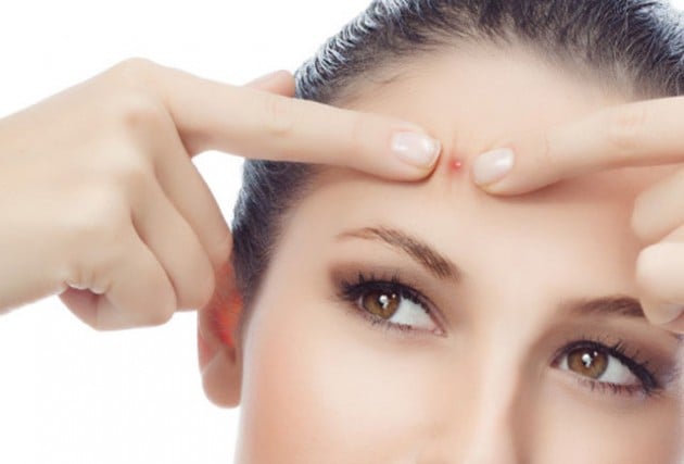 Mụn trứng cá sẽ không còn là nỗi lo nếu thay đổi những thói quen dưới đây thường xuyên-2