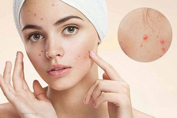 5 kiểu tóc ngang vai chuẩn mốt cho Tết 2023-11