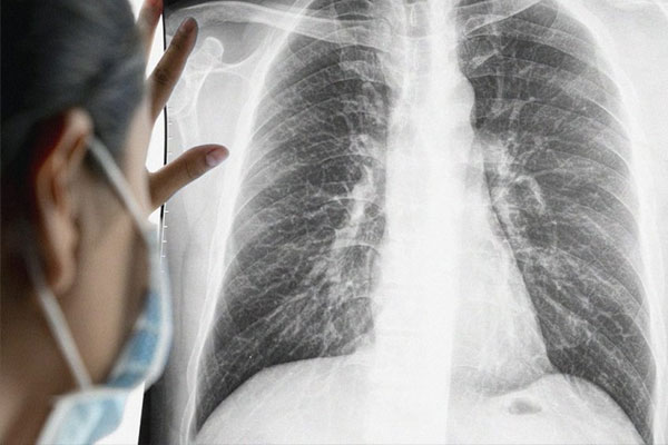 3 món nên ăn và 3 món không ăn để tránh kích thích mầm bệnh ung thư ruột-5