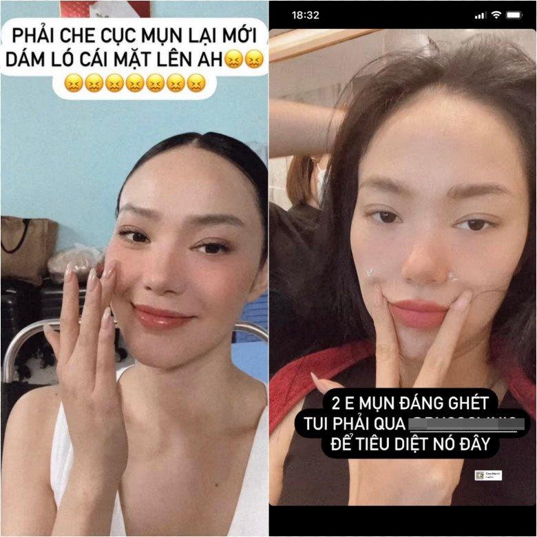 Minh Hằng chăm sóc da bằng cây lăn dành cho giới nhà giàu-2