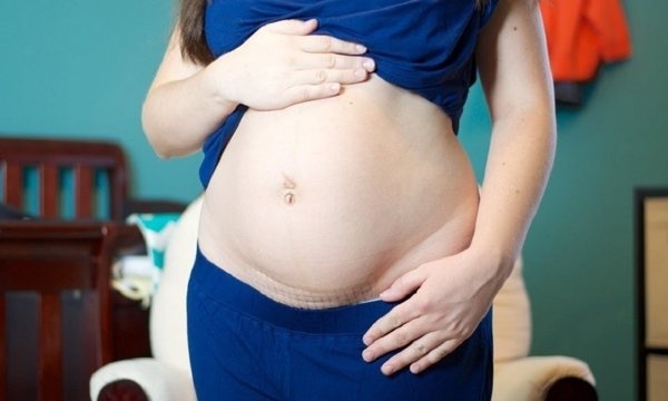 Mẹ bỉm sữa vừa sinh xong đã có bầu, mẹ chồng cười phá lên nhưng nghe bác sĩ nói mới chết lặng-1