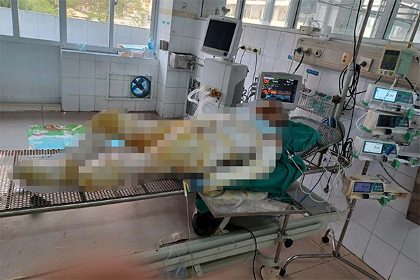 Ô tô bắt lỗi xe máy, nào ngờ dân mạng vạch ngược lỗi sai cơ bản của tài xế-3