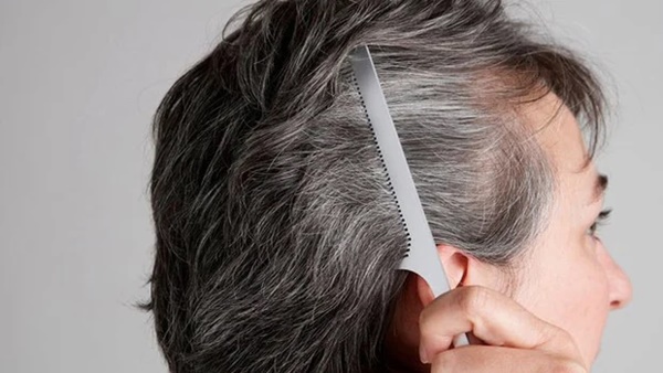 Ngày càng nhiều tóc trắng, có nên nhổ hay không? Sau 35 tuổi, nhất định phải lưu ý 2 điều mới tránh xa nguy cơ tóc bạc sớm-1