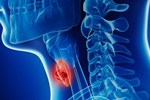 4 vùng cơ thể đau nhói chứng tỏ bệnh gan đã đi vào giai đoạn nặng, khám chữa ngay còn kịp-3