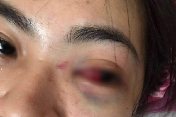 Thừa Thiên - Huế: Nam sinh lớp 11 bị bạn học đánh dã man nhưng không ai can ngăn-2