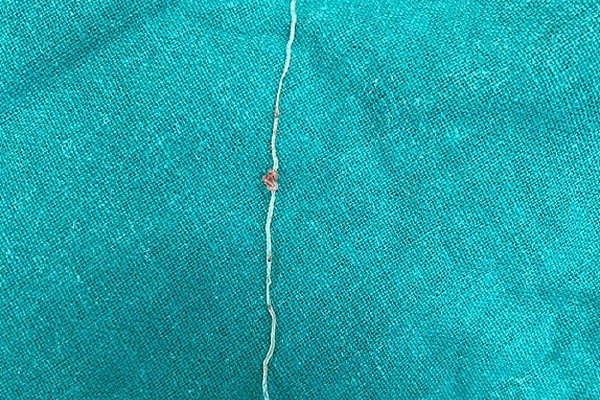 Bác sĩ nhắc nhở 6 món hải sản có nguy cơ cao nhiễm ký sinh trùng-4