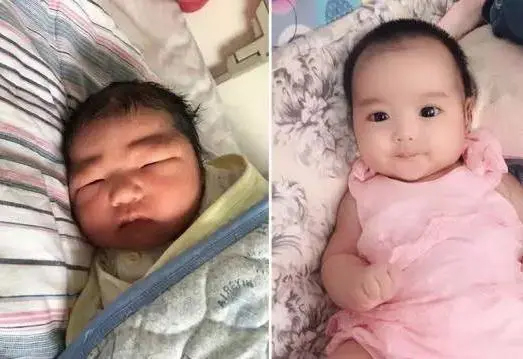 Bé có những đặc điểm này tưởng chừng xấu xí nhưng càng lớn lên càng xinh đẹp, bố mẹ đừng vội thất vọng-5