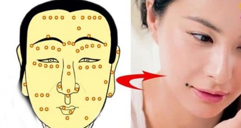 4 nốt ruồi cát tường đại phú đại quý cả đời giàu sang: Số 1 xấu đau đớn cũng không nên xóa-1