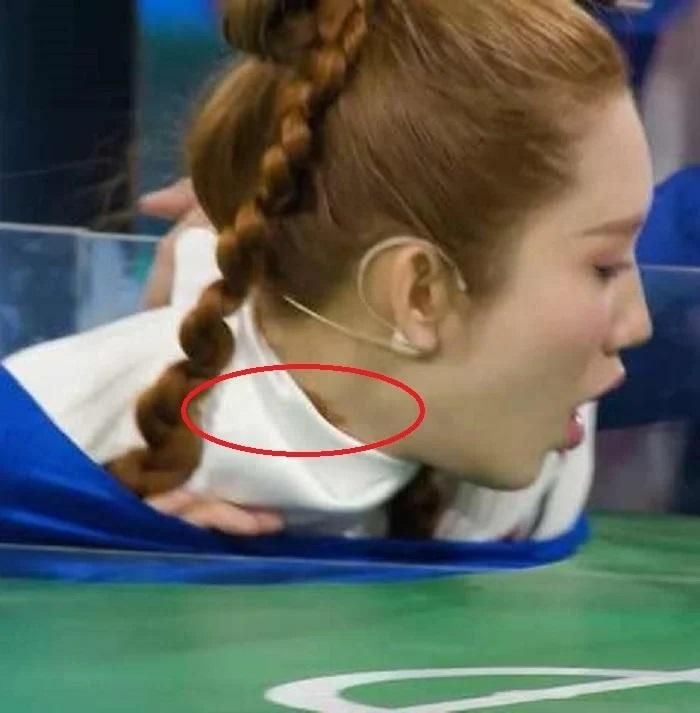 Thúy Ngân bị thương nghiêm trọng ở cổ-1