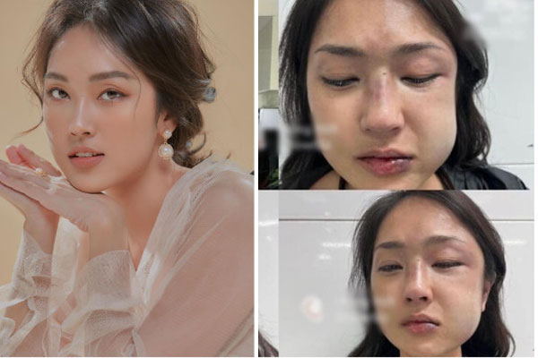 Misoa Kim Anh đang nổi đình đám cõi mạng là ai?-6