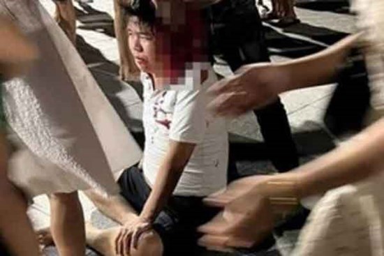 Clip: Khoảnh khắc dàn đèn sân khấu đổ sập đè khán giả ngồi xem nhạc nước ở Bình Dương