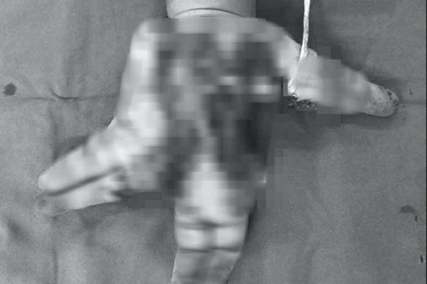 Clip: Điện thoại bất ngờ phát nổ, lửa bùng lên mặt người đàn ông-2