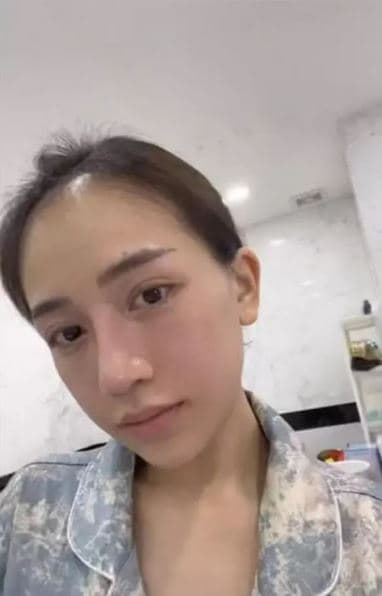 Ái nữ nhà đại gia Minh Nhựa đăng ảnh mặt mộc hậu dao kéo, nhan sắc thế nào?-2