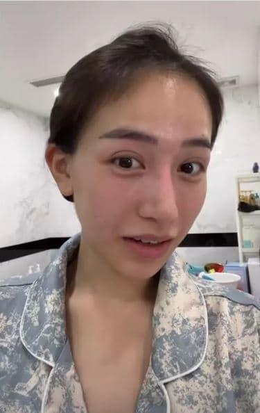 Ái nữ nhà đại gia Minh Nhựa đăng ảnh mặt mộc hậu dao kéo, nhan sắc thế nào?-3