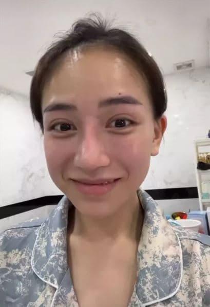 Ái nữ nhà đại gia Minh Nhựa đăng ảnh mặt mộc hậu dao kéo, nhan sắc thế nào?-4