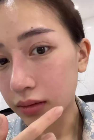 Ái nữ nhà đại gia Minh Nhựa đăng ảnh mặt mộc hậu dao kéo, nhan sắc thế nào?-5