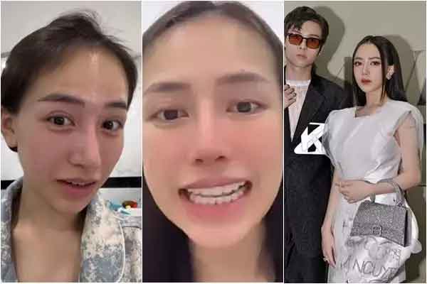 Bị nói thẩm mỹ hỏng mũi mọc từ trán, con Minh Nhựa đáp căng-6