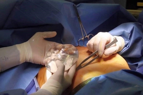 Cô gái 25 tuổi chết sau khi phẫu thuật thẩm mỹ tại KeyBeauty Center ở TP.HCM-1