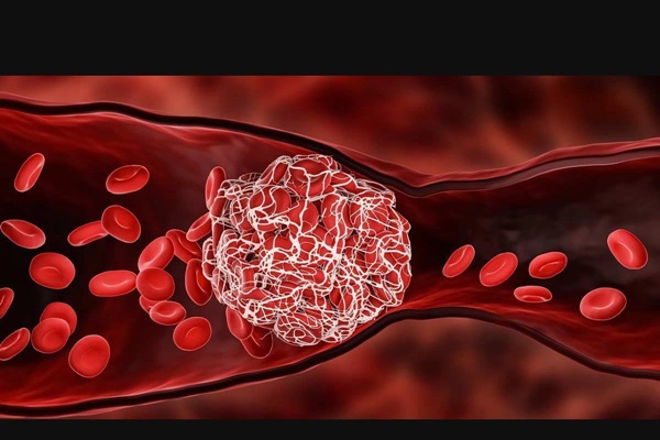 Mạch máu có 9 nỗi sợ vào mùa đông, bác sĩ cảnh báo người trên 40 tuổi cần cảnh giác-1