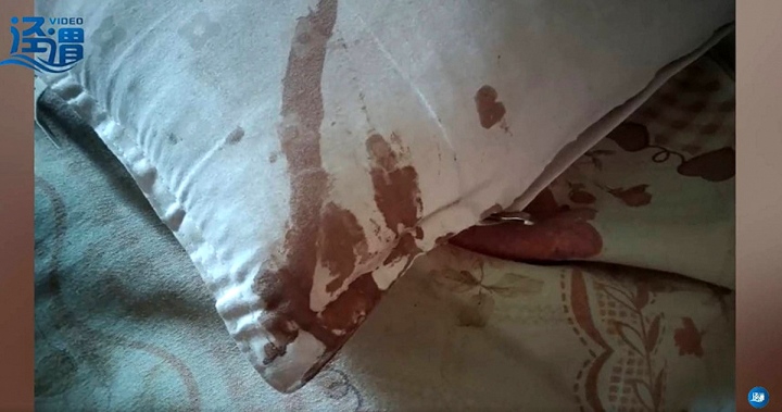 Thức giấc vì đau, người đàn ông sợ hãi thấy tai mình bị chuột cắn nham nhở-1