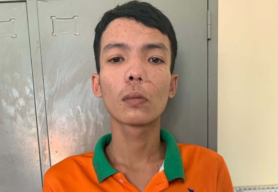 Nam công nhân gọi bạn đánh người quản lý-1