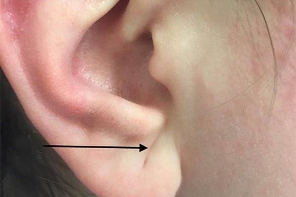 Đây là căn bệnh còn đáng sợ hơn cả ung thư, nhiều người Việt chủ quan nên chưa biết để phòng tránh kịp thời-7