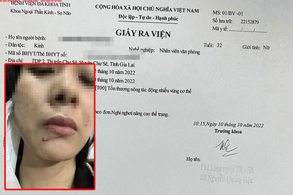 Siêu trộm 19 tuổi trong hơn 1 tháng ra tay trên 20 vụ-2