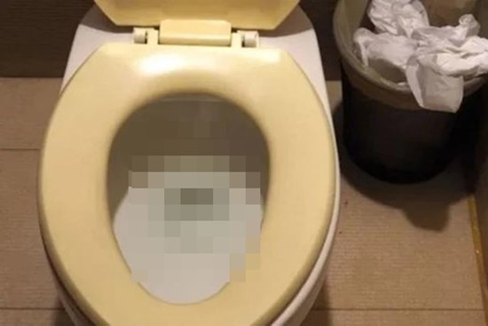 Nắp và bệ bồn cầu dùng lâu bị ố vàng: Làm theo cách này là sạch như mới, hết cả mùi hôi